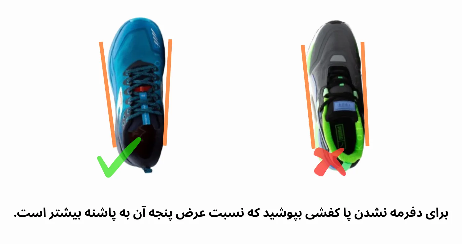 استفاده از کفش پنجه تنگ برای کجی انگشت پا 