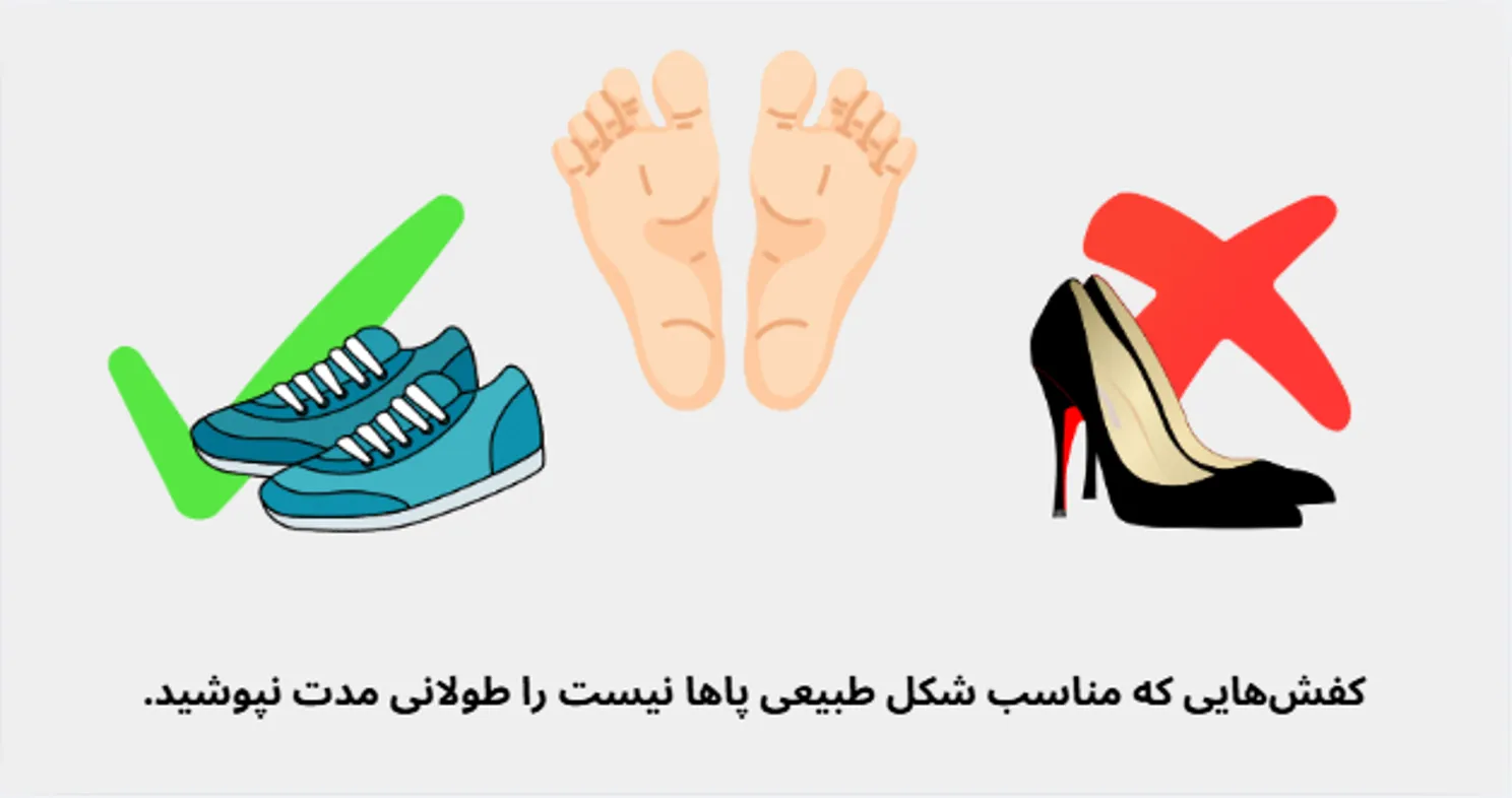 کفش نامناسب علت ایجاد بونیون است