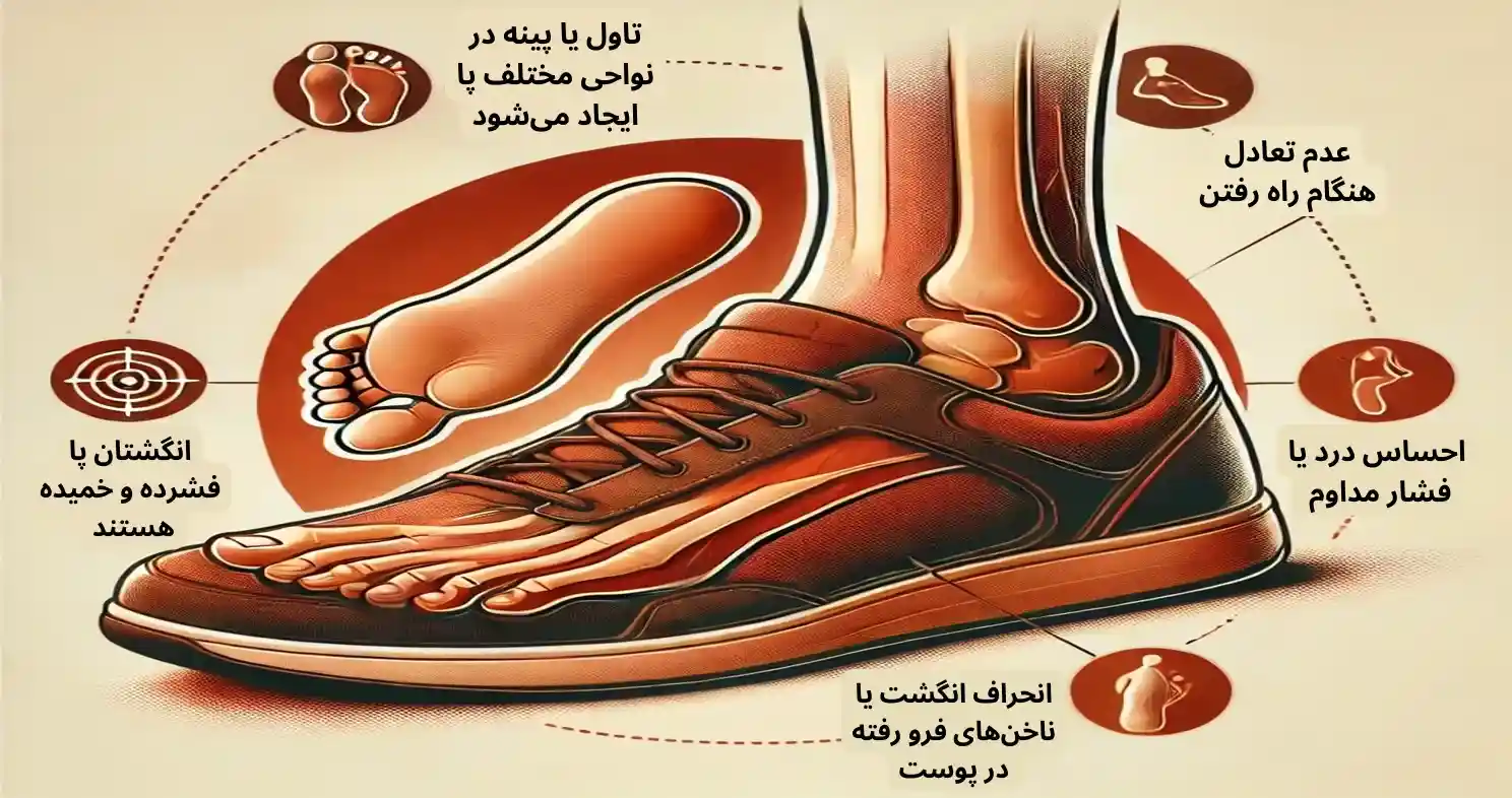 نشانههای اندازه نبودن کفش برای شما