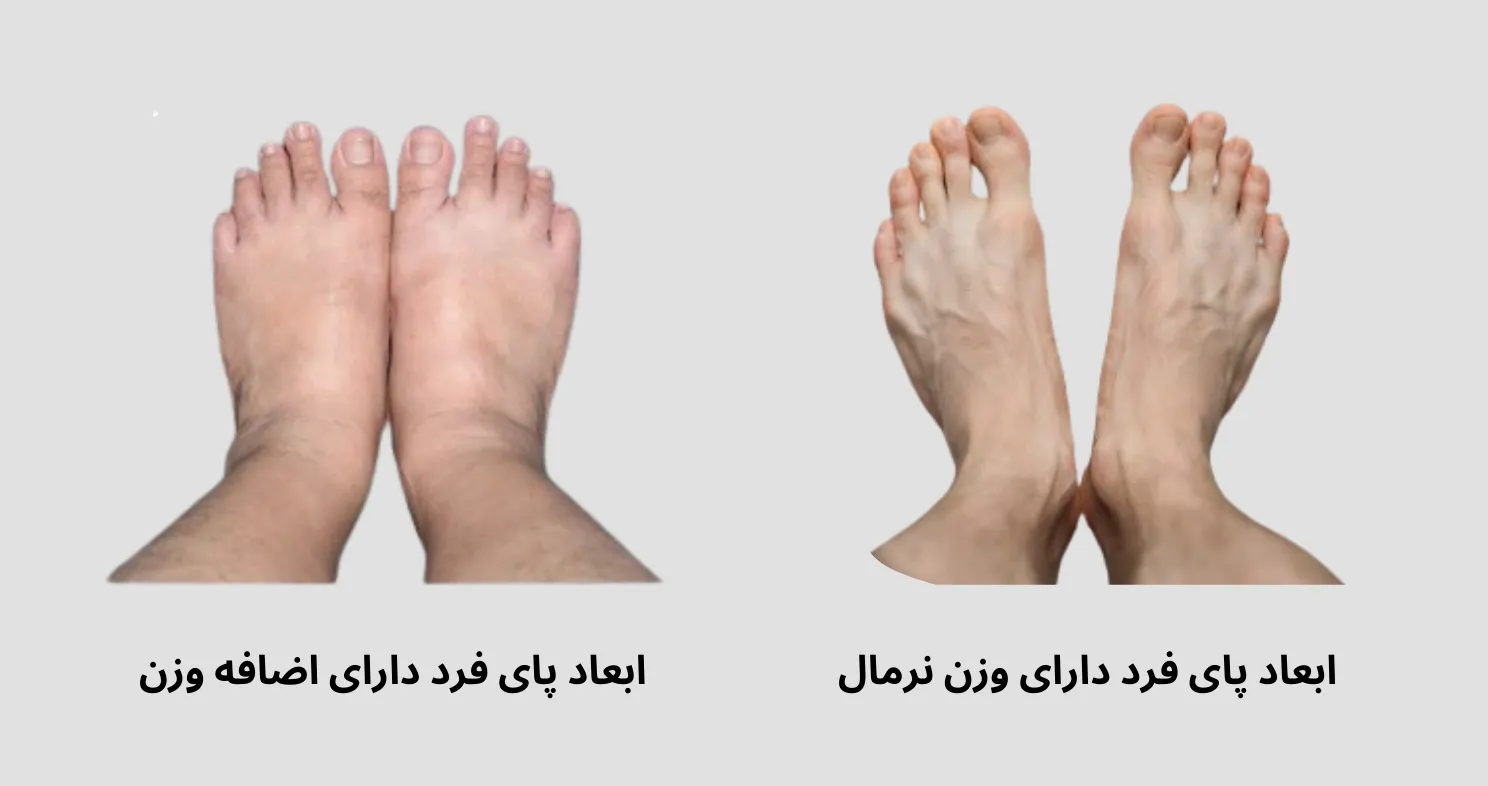 کاهش وزن یکی از راه های کاهش سایز پا و کفش است