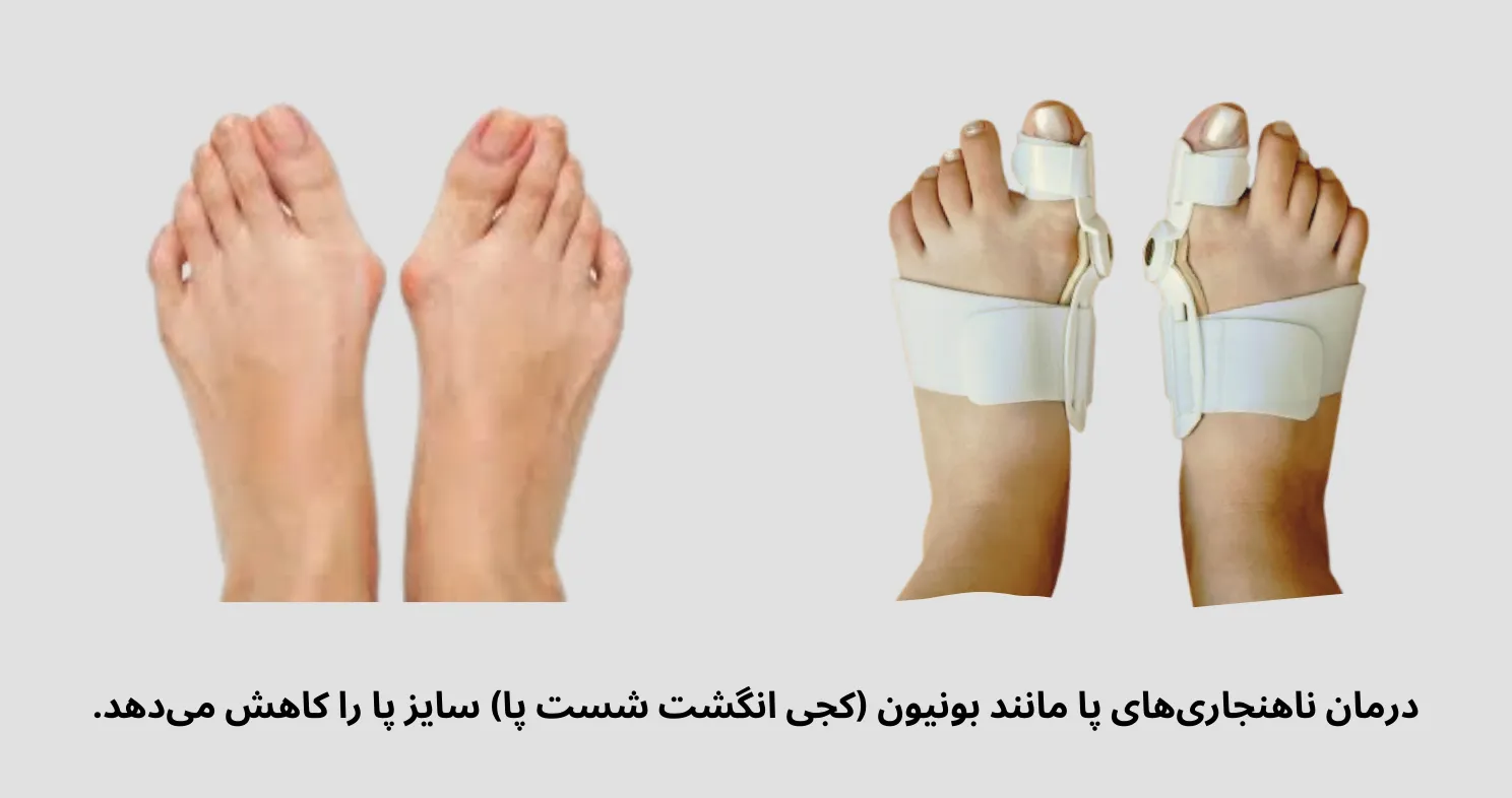 درمان ناهنجاری های پا برای تغییر سایز پا