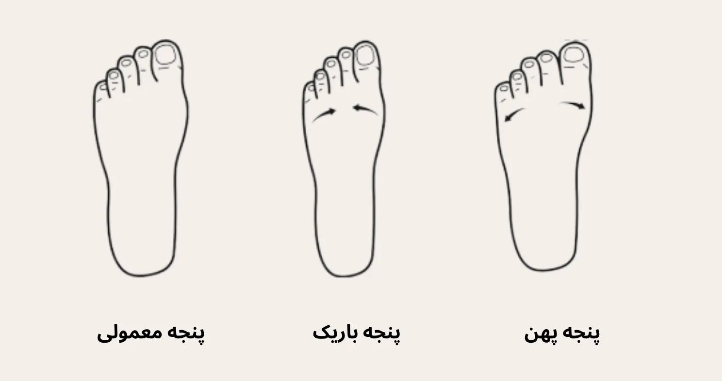 انواع شکل پا و تاثیر آن در بزرگی و کوچکی پا