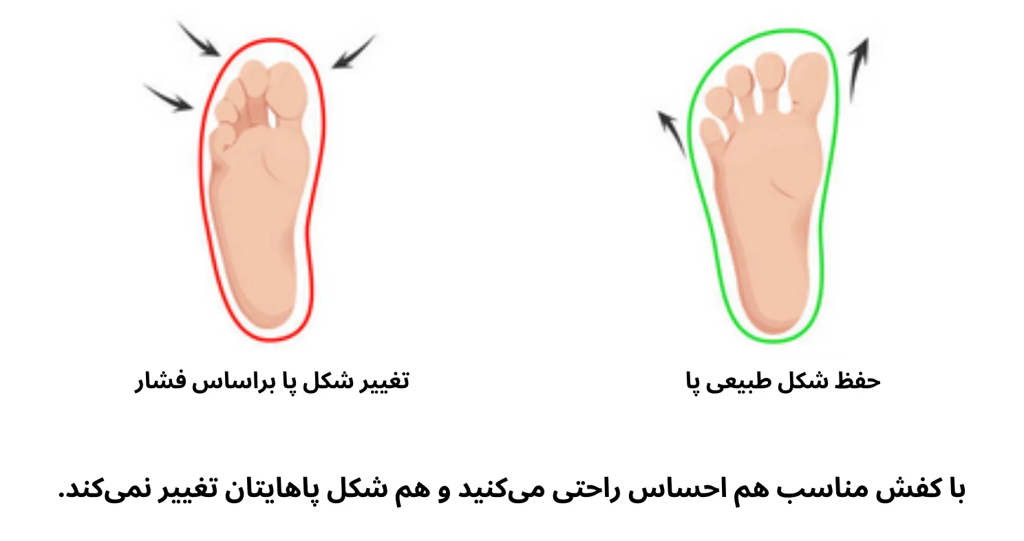 تغییر شکل در پاها با زدگی جلوی پا در کفش