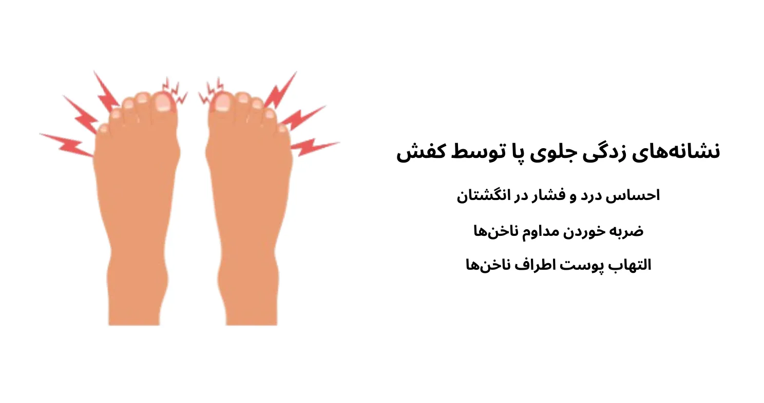 نشانه های کفش پنجه تنگ