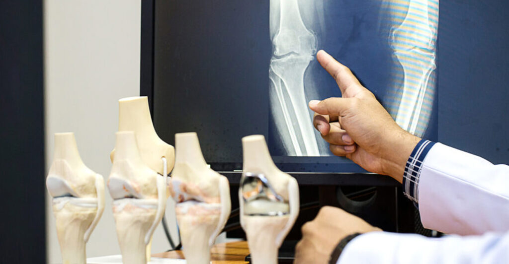 نظرات متخصصان ارتوپدی