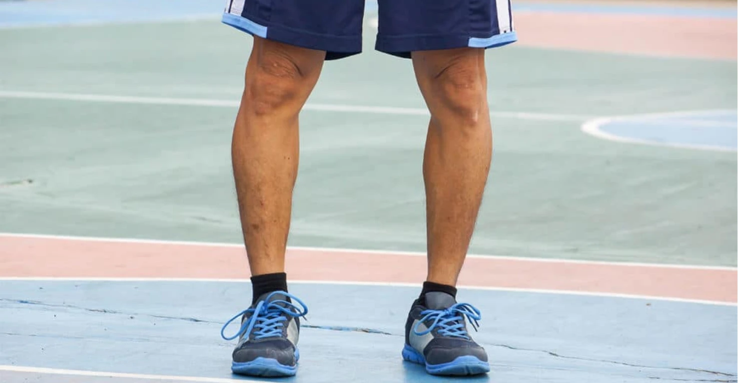 ویژگی‌های کفش مناسب پای پرانتزی